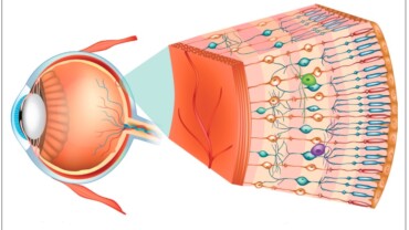 Vitreo-retinal disorders